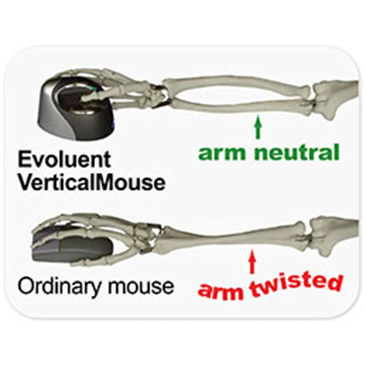 VerticalMouse 4 Right Mouse S877