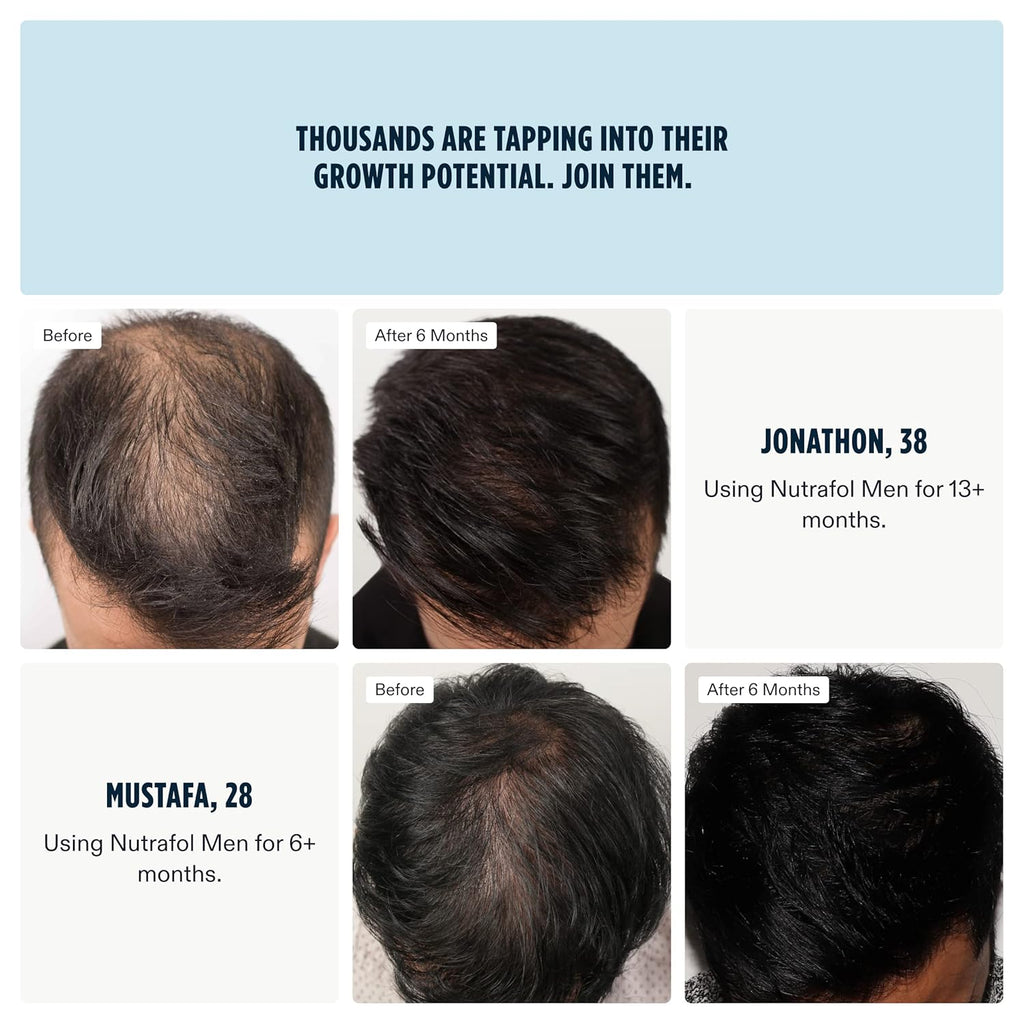 Men's Hair Growth Supplement (2-Month Supply) M617