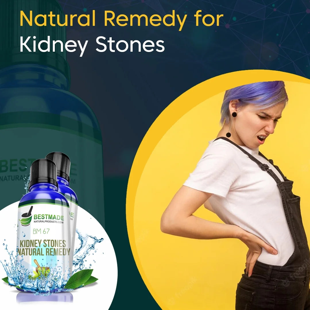 Kidney Stones Natural Remedy & Kidney Support 30 ML M727